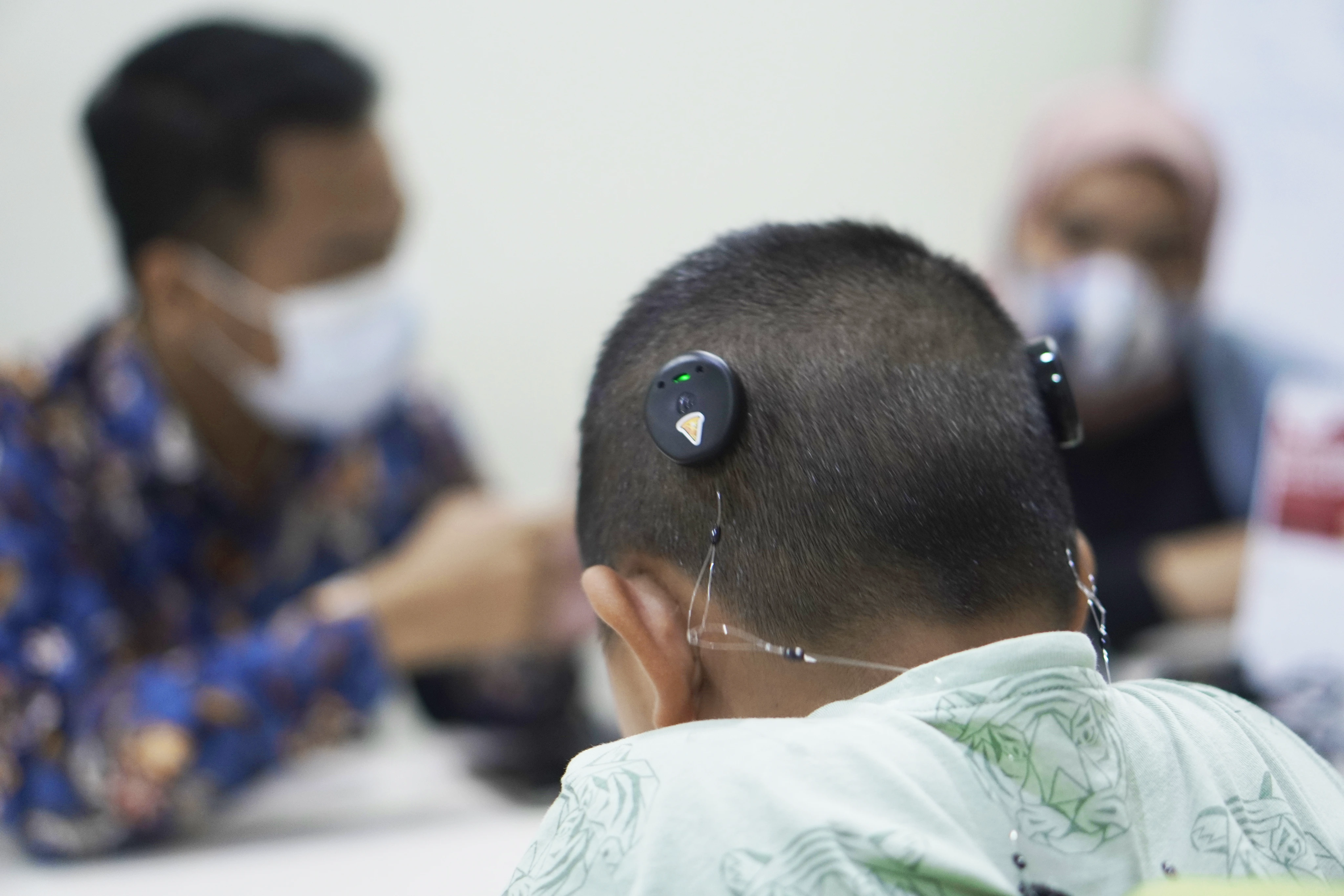 Cochlear Implant