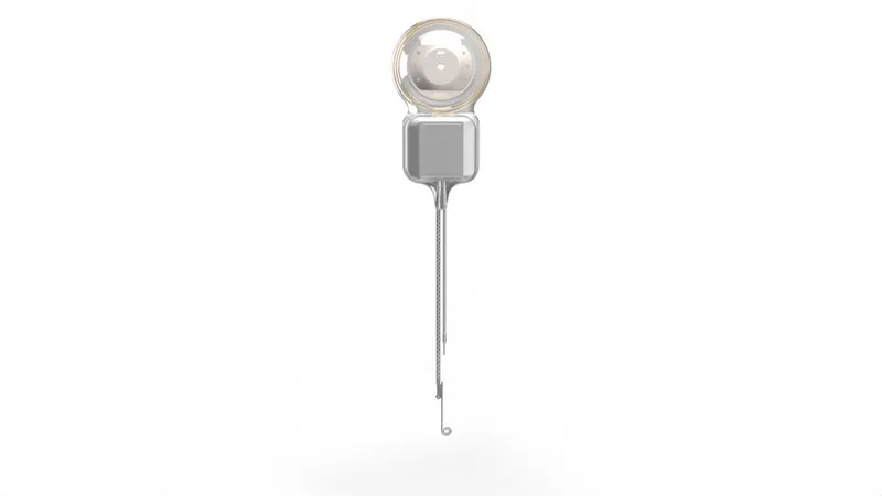 Cochlear Nucleus Nexa Implant Internal